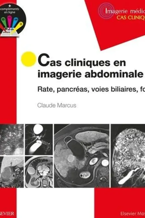Cas cliniques en imagerie abdominale. Rate, pancréas, voies biliaires, foie, Claude Marcus