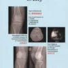 Les substituts de L'os du cartilage et du ménisque en 2013, Collectif